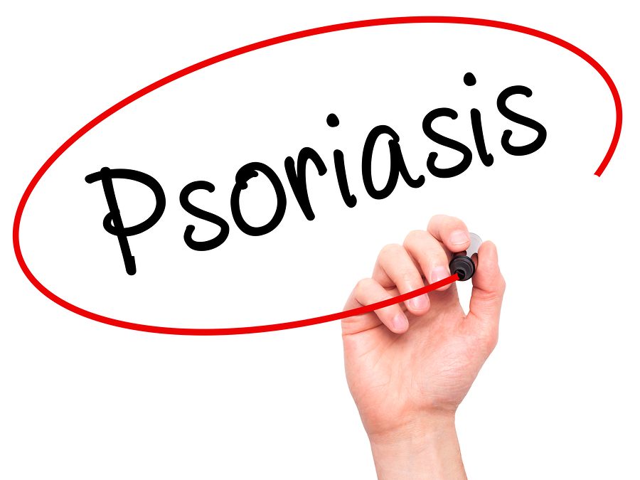 Home Care - 4 Ways to Prevent a Psoriasis Flare Up